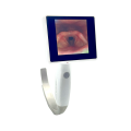 Anesthesia-video-laryngoscope-120x120
