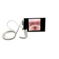 Anesthesia-video-laryngoscope-MD3-3-scaled-120x120