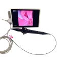 Electronic-bronchoscopy1-scaled-120x120