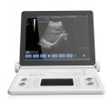 Youkey_F6_Ultrasound_Machine_Scanner_Front_View_3-1-120x120